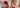 Baby mit Neurodermitis wird mit med Basiscreme von das boep eingecremt