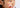 Kind mit Neurodermitis cremt sich mit boep Basiscreme ein
