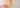 Person cremt sich Schuppenflechte mit boep med Basiscreme ein