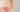 Person cremt sich Schuppenflechte mit boep med Basiscreme ein