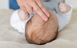 Naturkosmetik Mandelöl von das boep für Babys mit Kopfgneis oder Milchschorf Schuppen